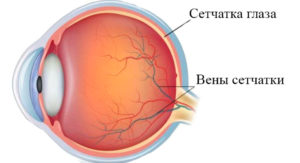Лечение ретинита в Израиле